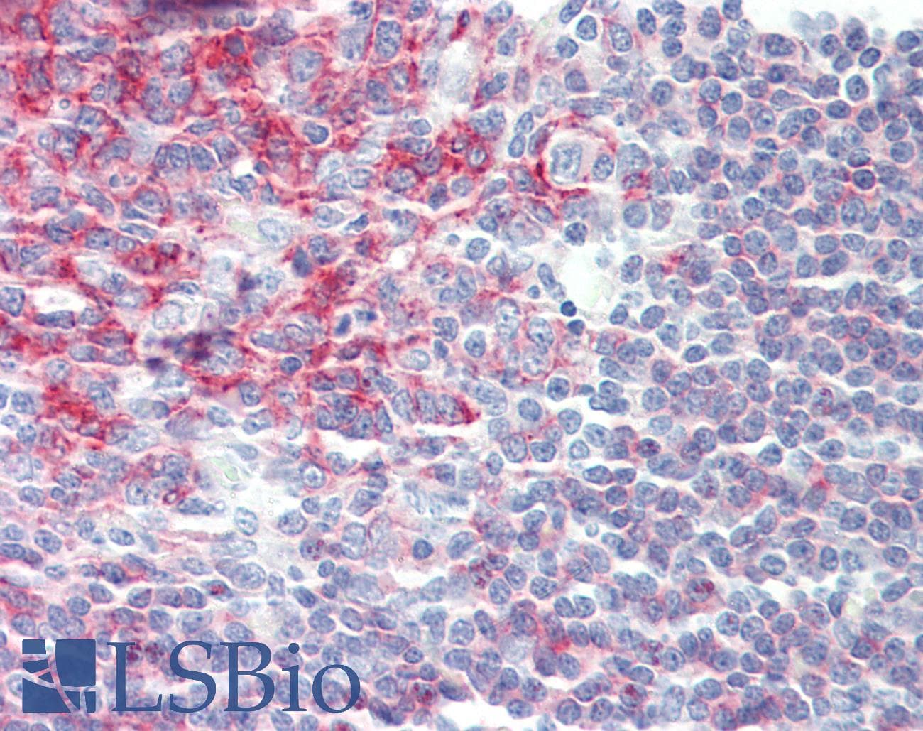IHC-plus™ CD20 Antibody (clone 4B4)