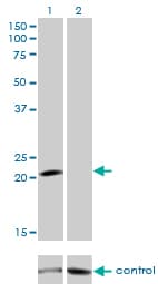 GCAP / GUCA1A Antibody (clone 2F7)