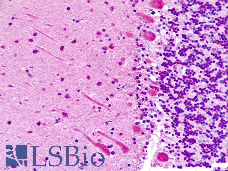 IHC-plus™ ABI1 / SSH3BP1 Antibody (aa81-108)