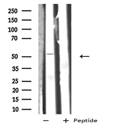 Polyclonal Rabbit anti-Human GIPR / GIP Receptor Antibody (IHC, IF, WB)