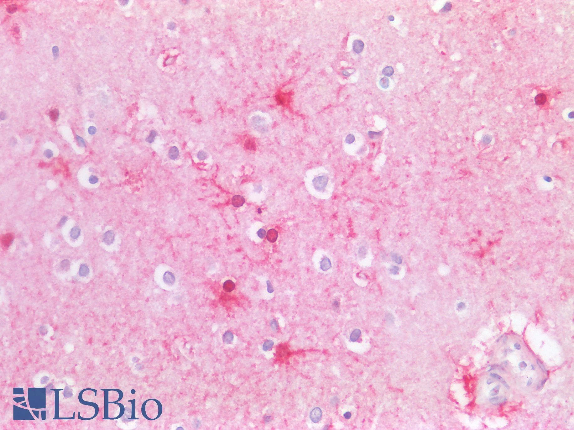 PathPlus™ IGF1 Antibody