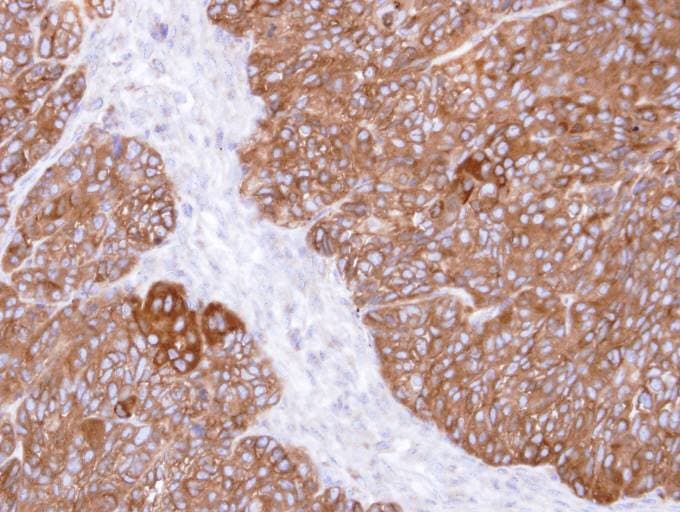Polyclonal Rabbit anti-Human MINPP1 Antibody (aa246-487, IHC, WB)