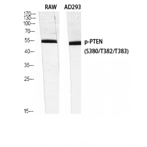 Polyclonal Rabbit anti-Human PTEN Antibody (320-400 aa, IHC, WB)