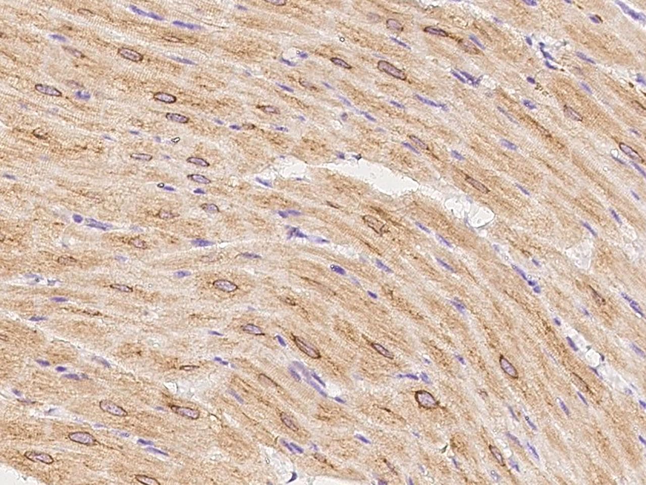 TRPC7 Antibody (Preservative Free)