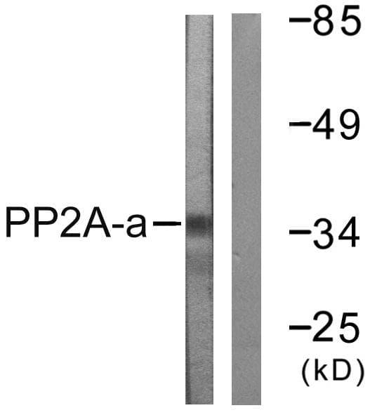 PP2Ac / PPP2CA Antibody (p307)