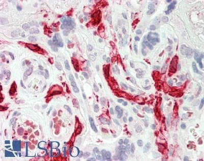 IHC-plus™ Polyclonal Rabbit anti-Human F13A1 / Factor XIIIa Antibody (N-Terminus, IHC, WB)