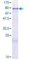 Human ACAD9 Protein (Recombinant GST)