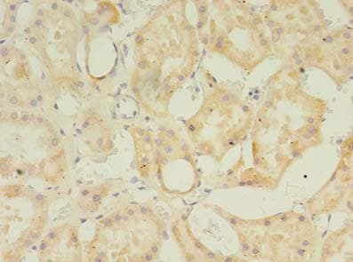 Polyclonal Rabbit anti-Human ZDHHC4 Antibody (IHC, WB)