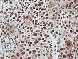 TRMT2A Antibody (clone OTI3D8, Carrier-free)