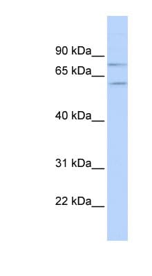 PIAS1 Antibody (N-Terminus)