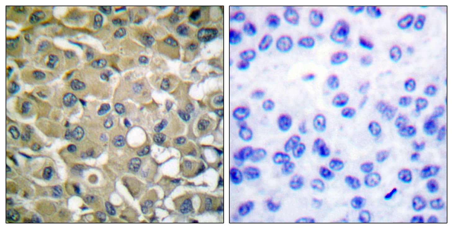 KRT18 / CK18 / Cytokeratin 18 Antibody (aa1-50)