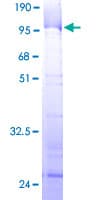 Human RRP1 Protein (Recombinant GST)