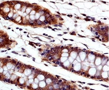 Monoclonal Mouse anti-Human CASP3 / Caspase 3 Antibody (clone CAS3836, WB)