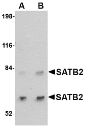 IHC-plus™ Polyclonal Rabbit anti-Human SATB2 Antibody (IHC, IF, WB)