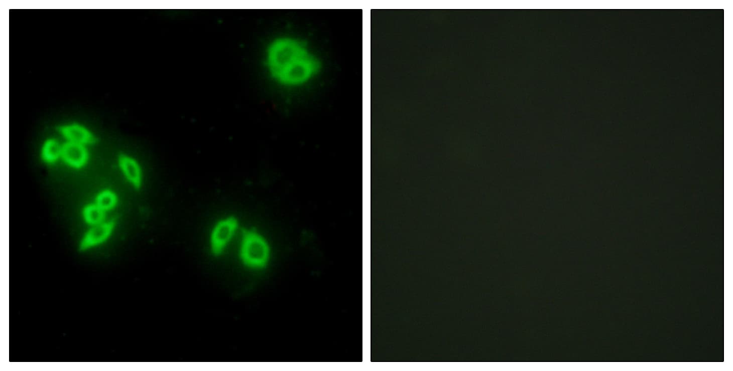 IHC-plus™ TNFAIP8 / SCC-S2 Antibody (aa31-80)
