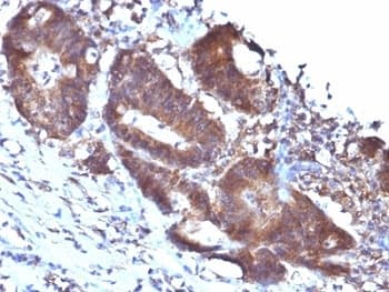TAGLN / Transgelin / SM22 Antibody (clone TAGLN/247)