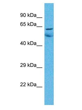 Polyclonal Rabbit anti-Human ZNF48 Antibody (aa397-446, WB)