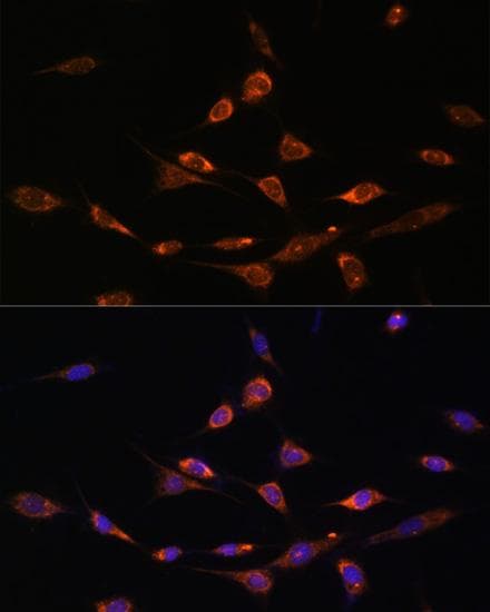 PAK3 Antibody