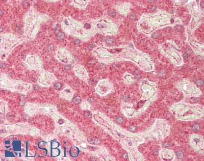 Polyclonal Rabbit anti-Human PVRL3 / Nectin-3 Antibody (aa467-516, IHC, WB)