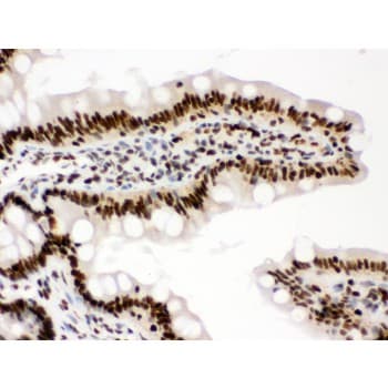 RBBP4 / RBAP48 Antibody (aa395-425)