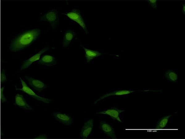 EIF5A Antibody (clone 8C1)