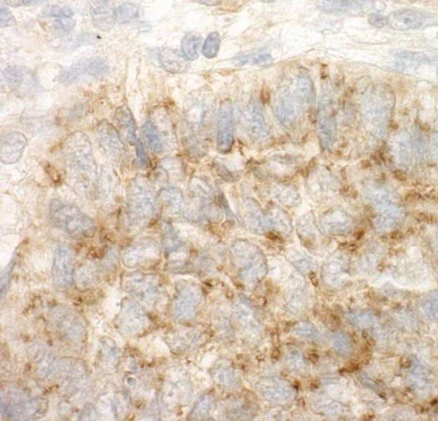 DAP-5 / EIF4G2 Antibody (aa125-175)