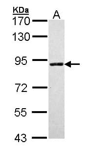 Polyclonal Rabbit anti-Human SLC26A8 / TAT1 Antibody (aa613-850, IHC, WB)