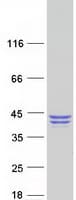 Human QPCT / QC Protein (Recombinant Myc-DDK (Flag))