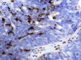 TP / Thymidine Phosphorylase Antibody (clone OTI1H7)