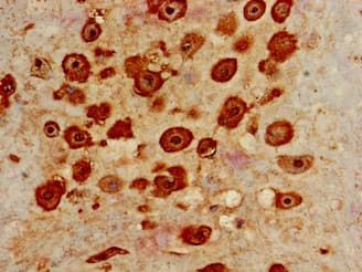 IHC-plus™ IL-22BP / IL22RA2 Antibody