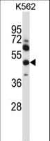 MMP13 Antibody (aa253-282)