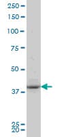 Polyclonal Rabbit anti-Human PBK / TOPK Antibody (Ile4, IHC, WB)