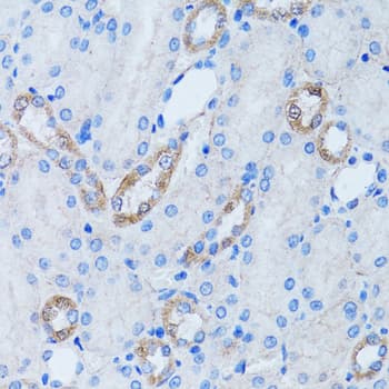 ARH / LDLRAP1 Antibody