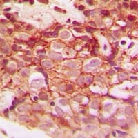 CLIP3 Antibody (Internal)