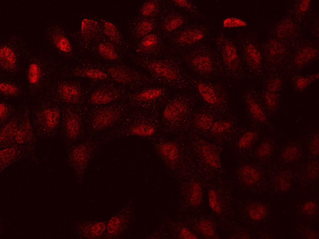 WBP11 Antibody