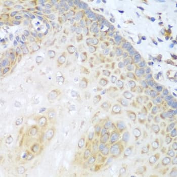 PRKCD / PKC-Delta Antibody