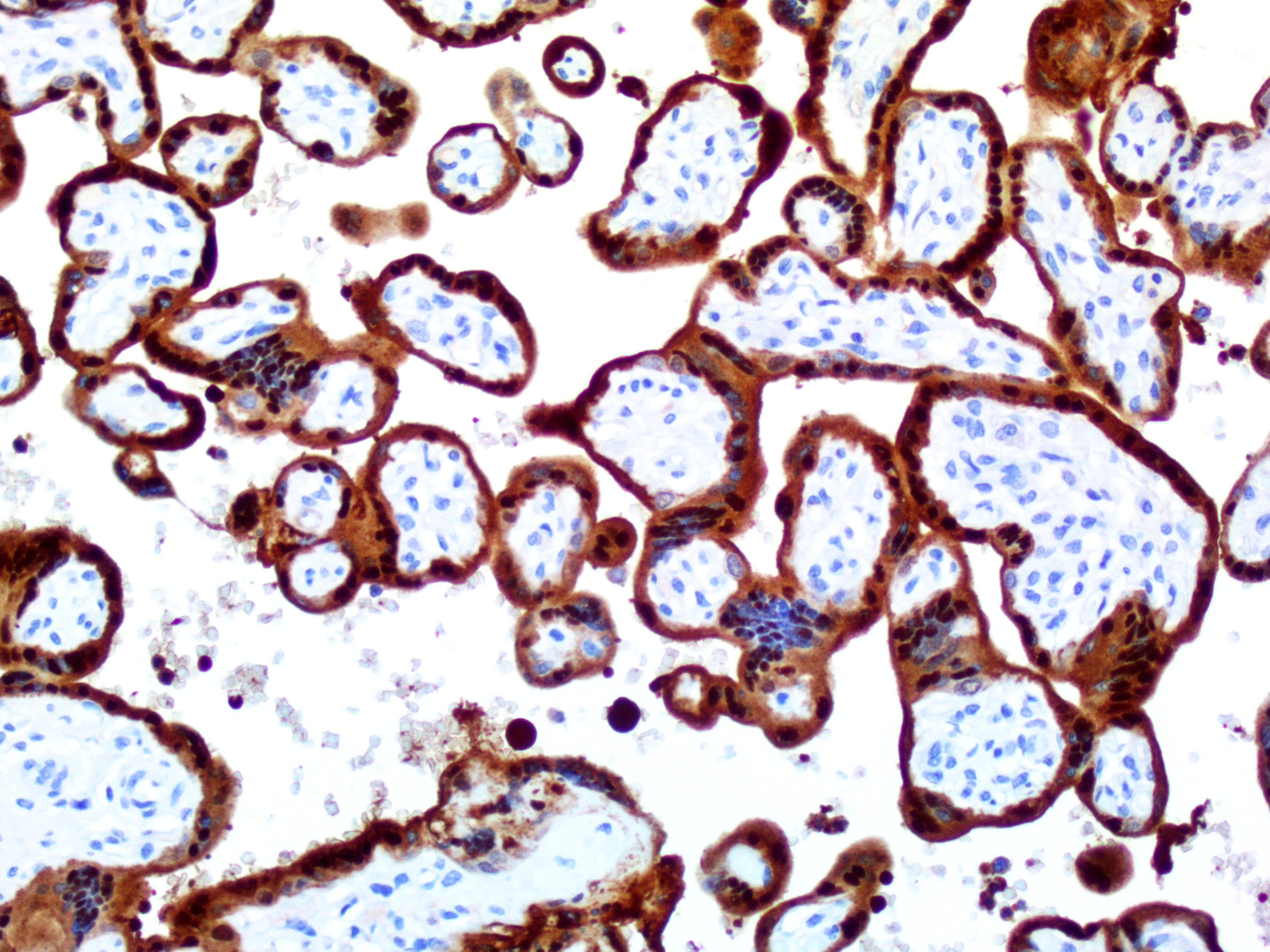 Monoclonal Mouse anti-Human S100P Antibody (clone UMAB24, IHC, IF, WB)