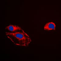 Polyclonal Rabbit anti-Human PEBP1 / RKIP Antibody (Internal, IF, WB)