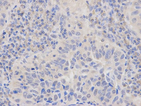 IHC-plus™ LY96 / MD2 / MD-2 Antibody