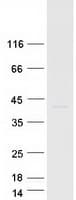 Human SLC30A7 Protein (Recombinant Myc-DDK (Flag))