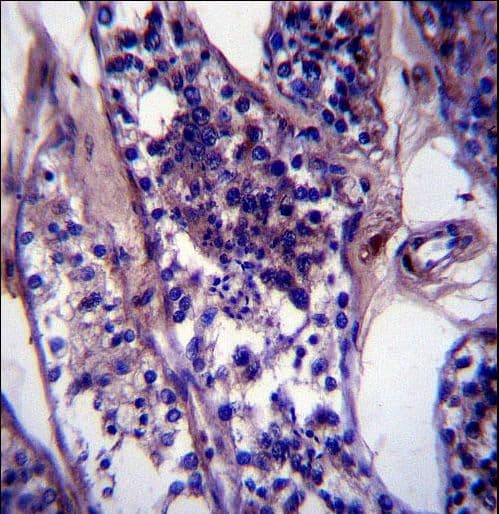 SPDL1 / CCDC99 Antibody (aa459-488)