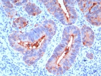 CEA / Carcinoembryonic Antigen Antibody (clone C66/195)