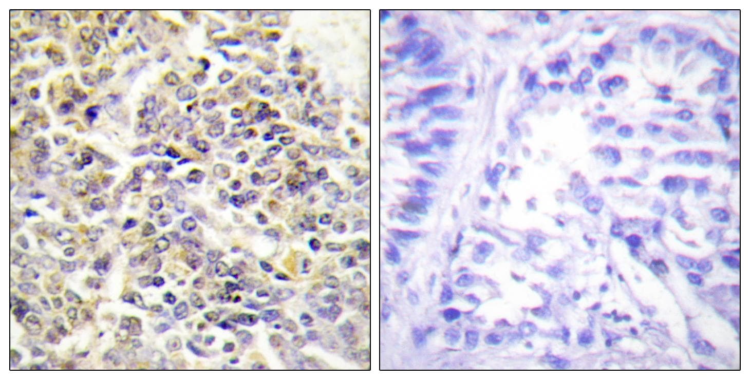 Polyclonal Rabbit anti-Human PYCARD / ASC / TMS1 Antibody (IHC, WB)