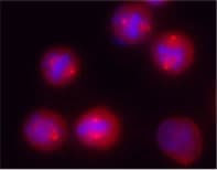 IHC-plus™ TUBG1 / Tubulin Gamma 1 Antibody (C-Terminus)