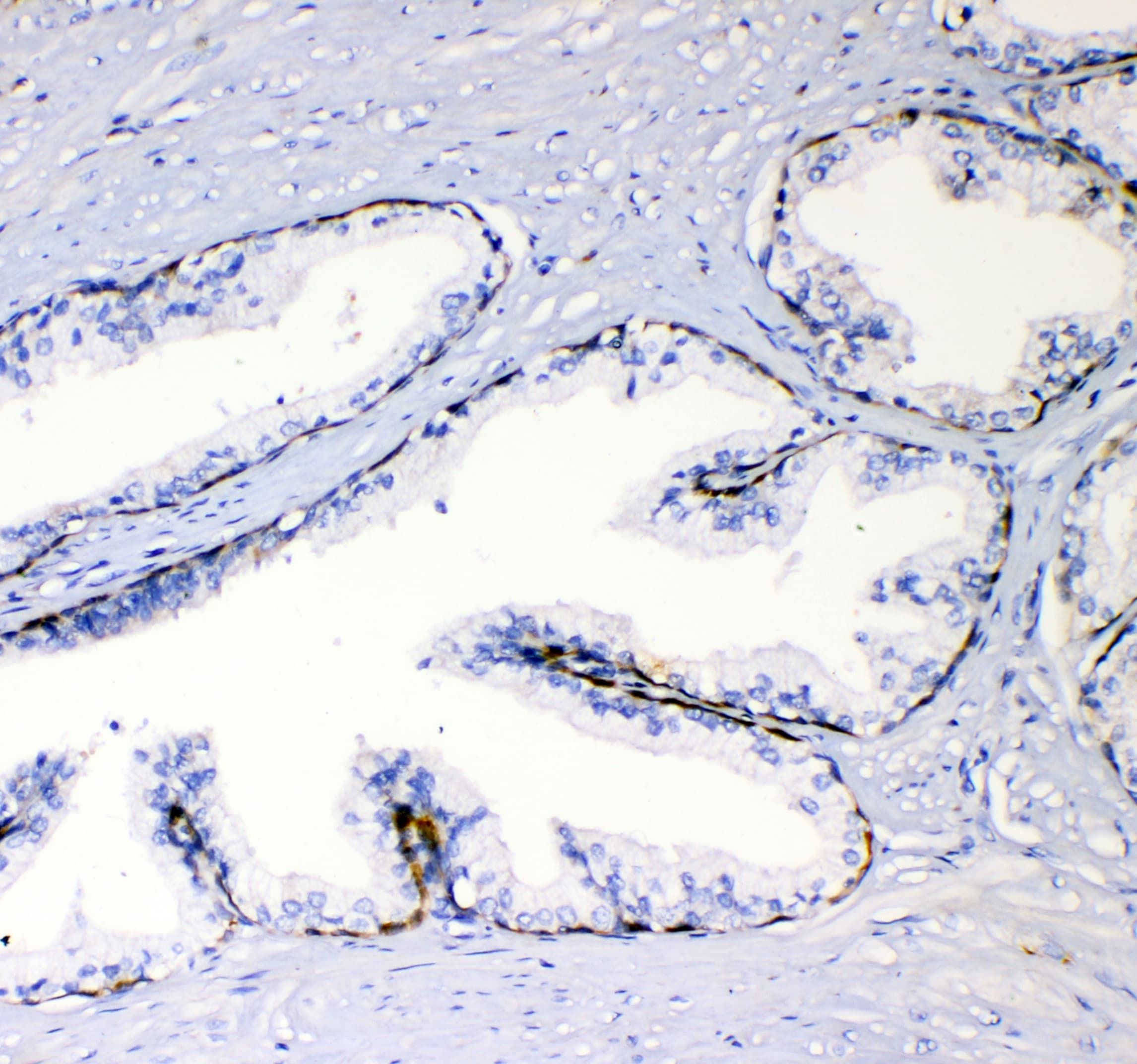 Polyclonal Rabbit anti-Human TNFSF15 / TL1A / VEGI Antibody (WB)