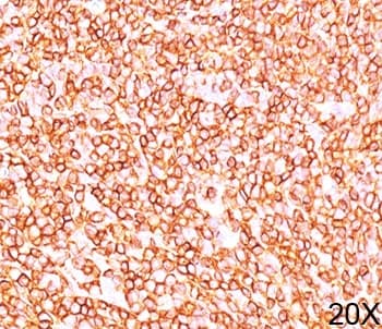 CD45RB Antibody (clone PD7/26, Ready-to-Use)