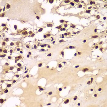 Polyclonal Rabbit anti-Human ZNF20 Antibody (IHC, WB)