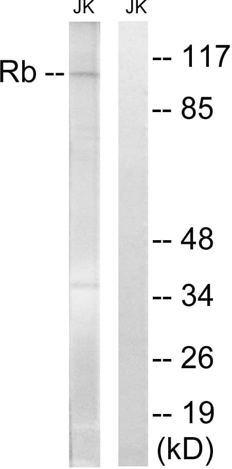 RB1 / Retinoblastoma / RB Antibody (aa581-630)