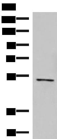 POLD2 Antibody