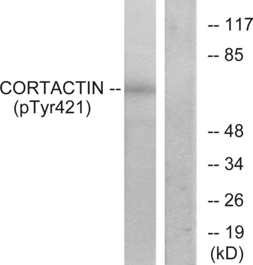 Polyclonal Rabbit anti-Human CTTN / Cortactin Antibody (phospho-Tyr421, WB)